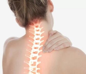 Osteocondrosis cervical