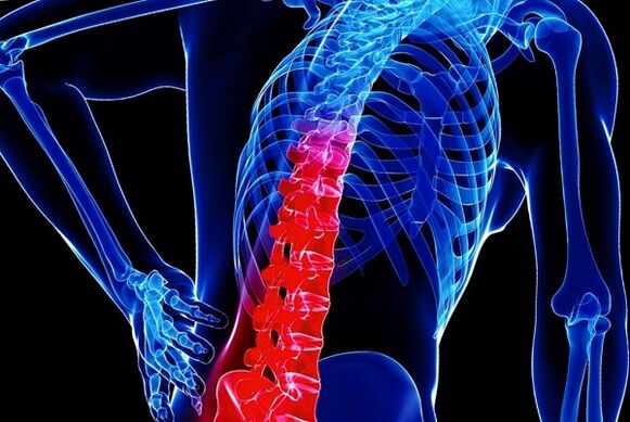 Las razones para el desarrollo de la osteocondrosis torácica