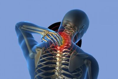 Dolor en el cuello con osteocondrosis