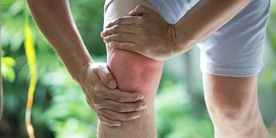 Dolor intenso durante la actividad física debido a artrosis de la articulación de la rodilla.
